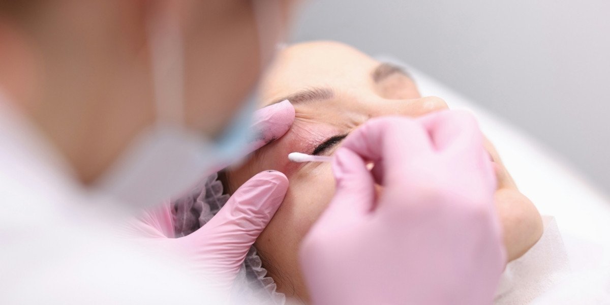 Why Eyelid Lifts Are Rising in Popularity for Women Under 40