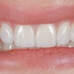 Why Your Smile Is More Connected to Your Overall Health Than You Think